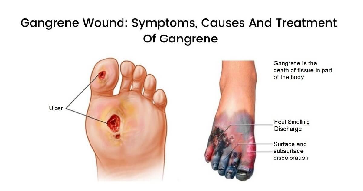 Guidelines for Wound Photography