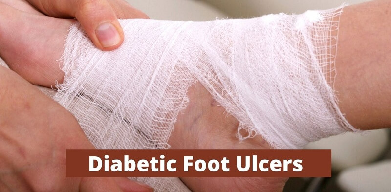 Top Common Causes Of Non-healing Diabetic Foot Ulcers