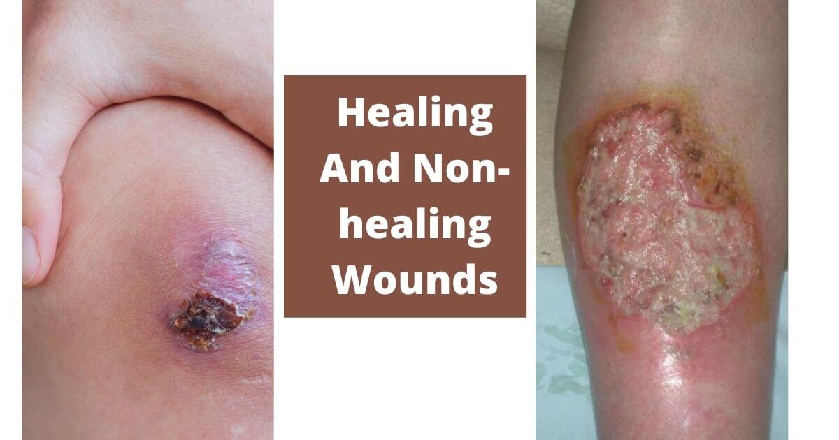 Guidelines for Wound Photography