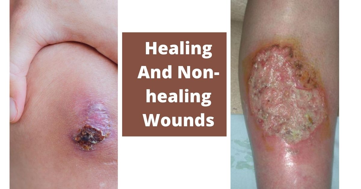 Guidelines for Wound Photography